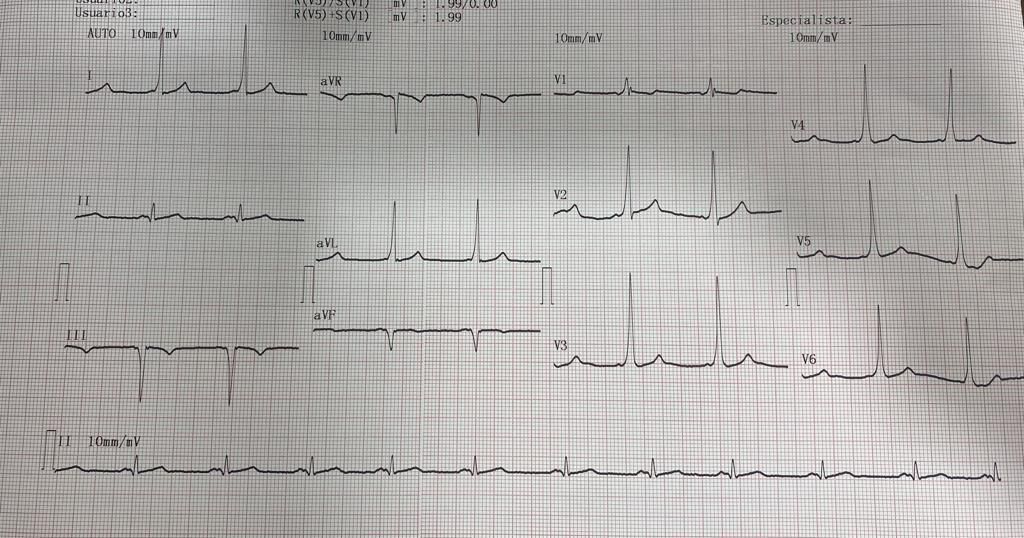 Consulta cardiologica